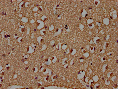ADAR Antibody