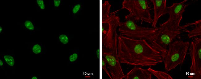 ADAR1 antibody [N3C1], Internal