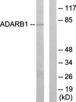 ADARB1 antibody