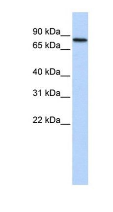 ADARB2 antibody