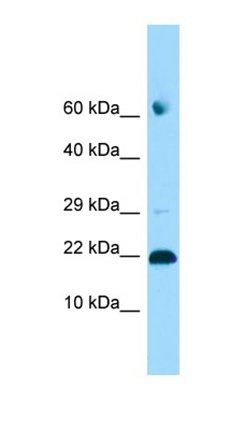 ADAT2 antibody