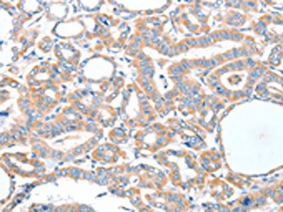 ADCK1 Antibody