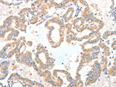 ADCK1 Antibody