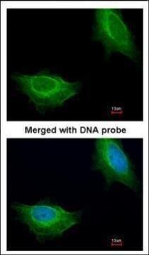 ADCK1 antibody