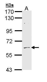 ADCK1 Rabbit Polyclonal Antibody