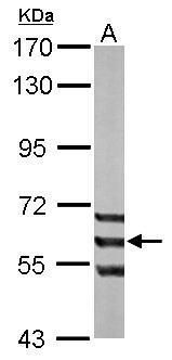 ADCK1 Rabbit Polyclonal Antibody