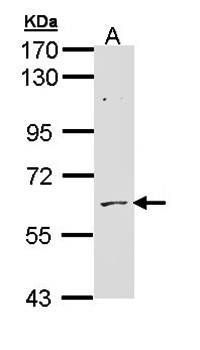 ADCK1 antibody