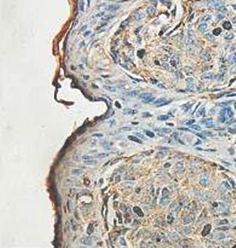 ADCK1 Rabbit Polyclonal Antibody