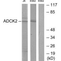 ADCK2 antibody