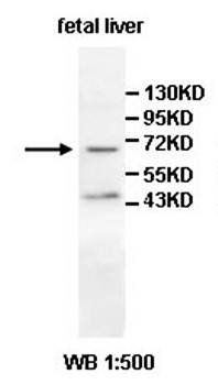 ADCK2 Rabbit Polyclonal Antibody