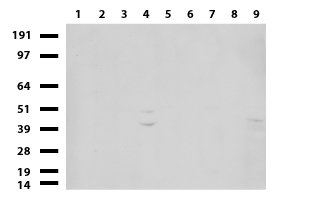 ADCK3 (COQ8A) antibody