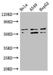 COQ8B Antibody