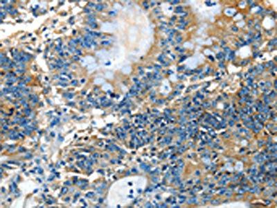 ADCK4 Antibody
