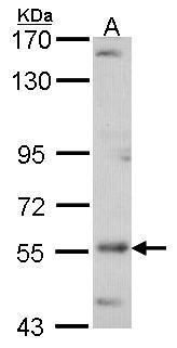 ADCK4 antibody [N3C3]