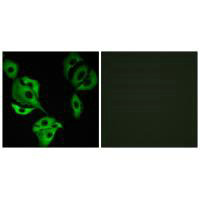 ADCK4 Antibody
