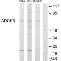 ADCK5 antibody