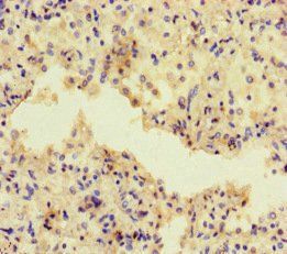 ADCY1 Antibody