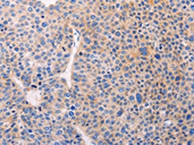 ADCY1 antibody