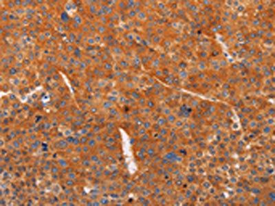 ADCY1 Antibody