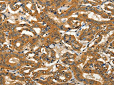 ADCY3 Antibody