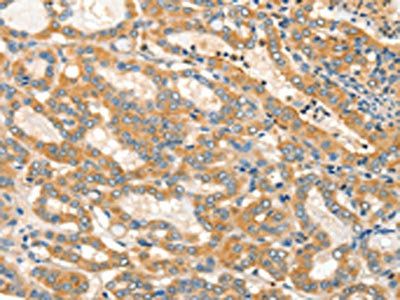 ADCY3 Antibody