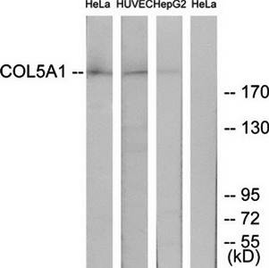 ADCY5/6 antibody