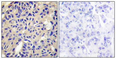 Collagen V α2 Antibody