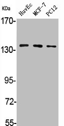 ADCY5/ADCY6 Antibody