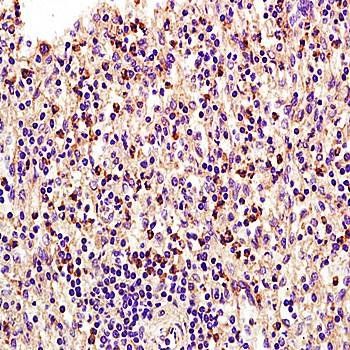 ADCY6 Rabbit Polyclonal Antibody