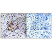 ADCY9 antibody