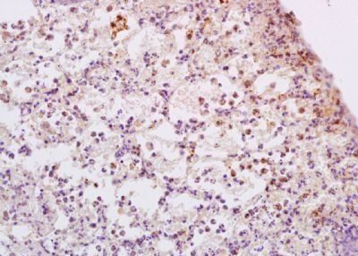 ADCY9 antibody