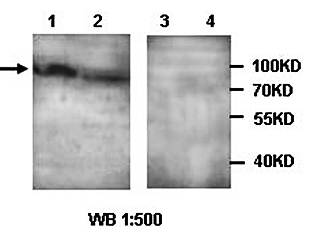 ADCY9 Rabbit Polyclonal Antibody