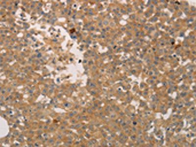 ADCYAP1R1 Antibody