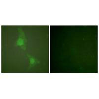 ADD1 (Ab-726) Antibody