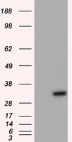 Adenylate Kinase 1 (AK1) antibody