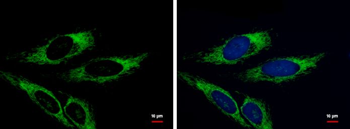 Adenylate kinase 4 antibody