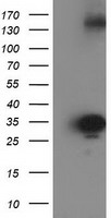 Adenylate kinase 5 (AK5) antibody