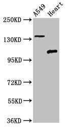 ADGRA2 antibody