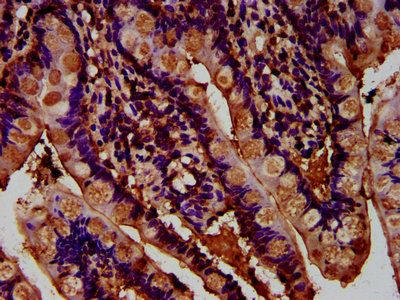 ADGRG1 Antibody