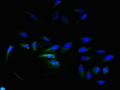ADGRL4 Antibody