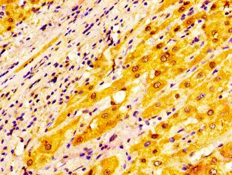ADH1A Antibody