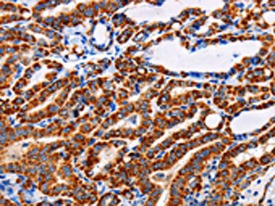 ADH1A Antibody