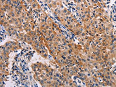 ADH1A Antibody