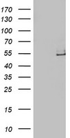 ADH1B antibody