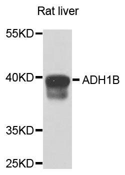 ADH1B antibody