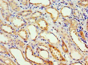 ADH4 Antibody