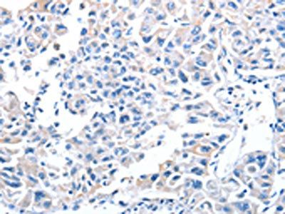 ADH4 Antibody