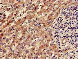 ADH5 Antibody