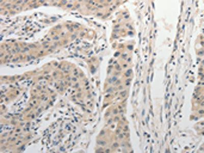 ADHFE1 antibody