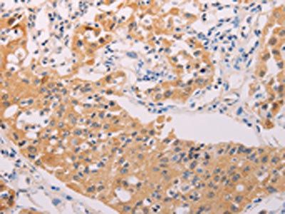ADHFE1 Antibody